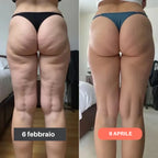 Leggings 3D FitVera™ - Anticellulite e Modellanti