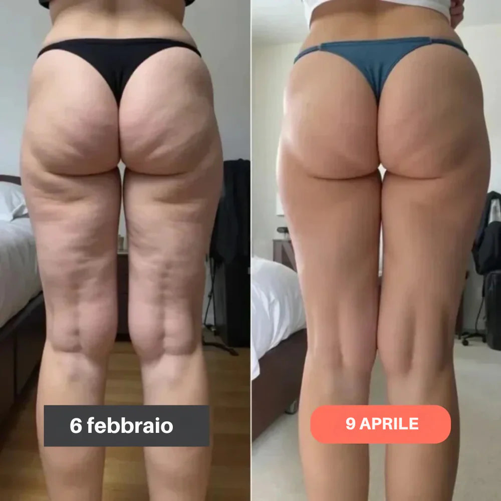 Leggings 3D FitVera™ - Anticellulite e Modellanti